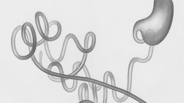 How to Strengthen the Gut Microbiome: Fiber, Fermented Foods, and Lifestyle Strategies