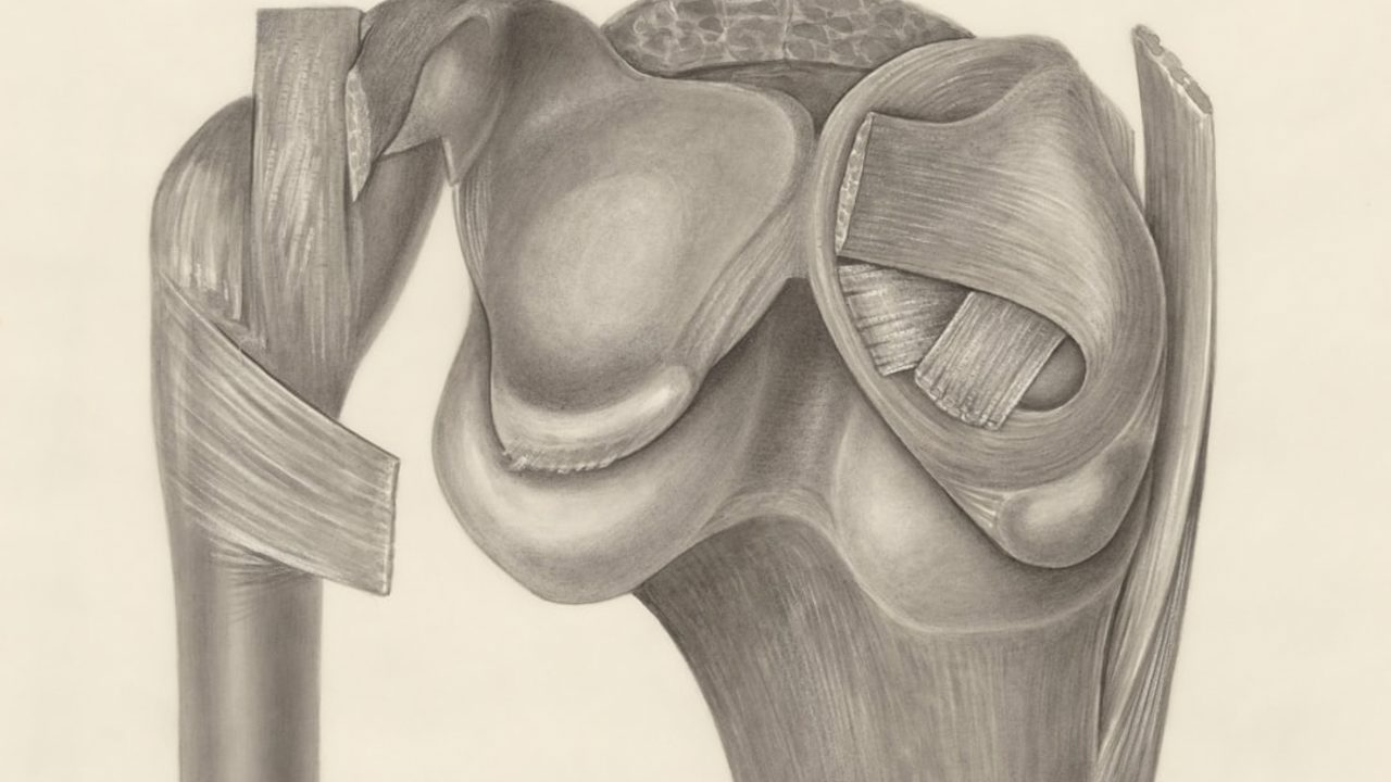 What Is Hip Impingement in Pilates, and How to Increase Glute Activation?